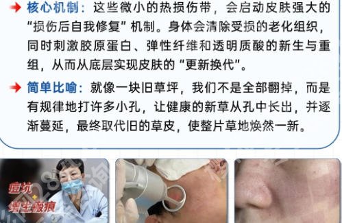 合肥正规医院点阵激光多少钱?低至3k起含人气医院推荐!