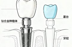 无锡种植牙好的3家医院有谁？本地热门医院盘点+各家优势对比