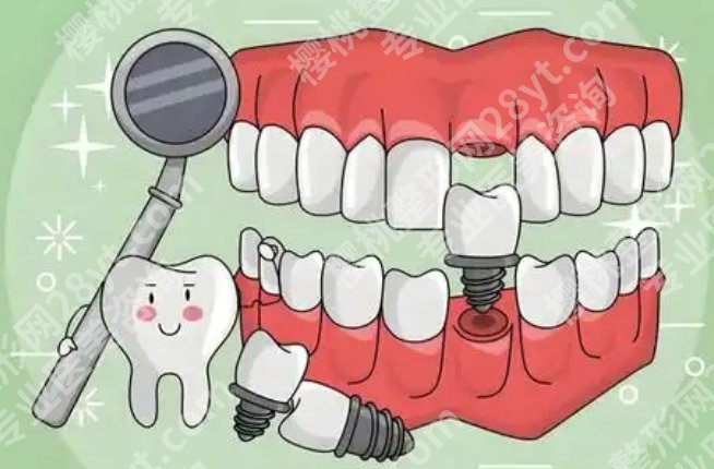 泰安种植牙好的医院，技术和口碑都过关的就这几家
