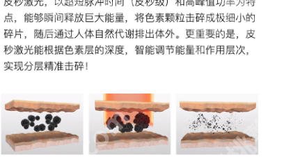 渭南激光祛斑哪里比较好?市中心医院设备先进、祛斑点痣皮肤科推荐!