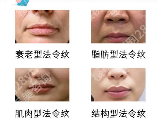 上海除皱价格排名怎么样？大致在4144~66,767左右不等以及2026更新医院名单抢先看！