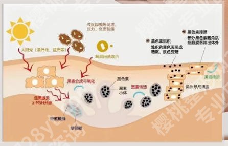 周口哪里有祛斑效果好的？五家本地人常去的正规医院深度盘点和技术口碑全解析！！