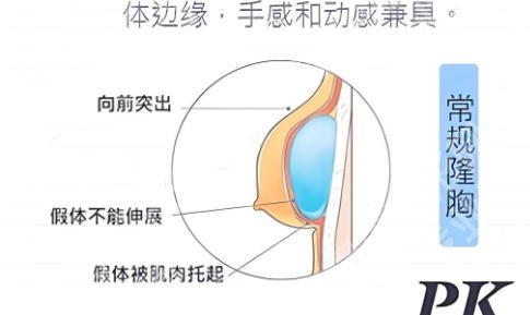 暨南大学附属第一医院丰胸专家有哪些?肖丽玲、谢波等医生技术超群!