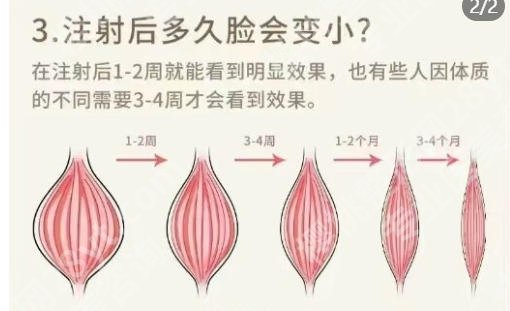 南充哪里可以打瘦脸？南充市中心医院、川北医学院附属医院靠谱可选!