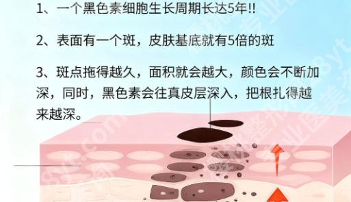 宁波激光祛斑的医院哪里好?附价格表、医院推荐与避坑指南!