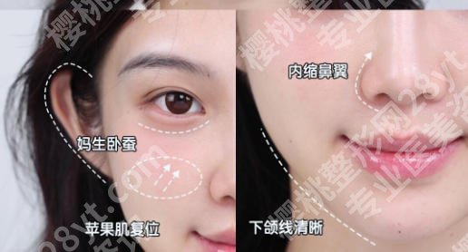 滁州哪家医院有美容科呢？2026年本地口碑与技术兼具的医院推荐