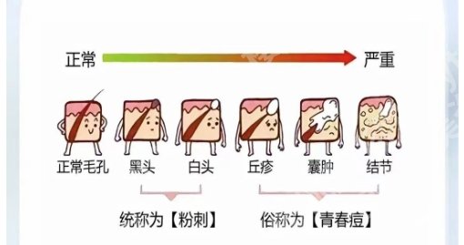 漳州激光祛痘医院哪里好?市医院、恩僖医学美容技术支持强、收费实在没套路!
