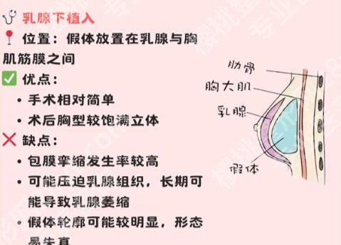 上海第九人民医院丰胸手术价格揭晓！费用一般都是2w左右含人气医生介绍！