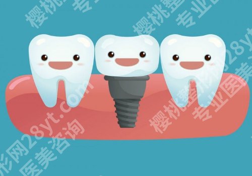 锦州种植牙哪里比较好?2026更新TOP榜单揭晓