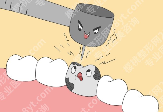 佛山种植牙价格是多少钱？真实费用全拆解，看完不被坑