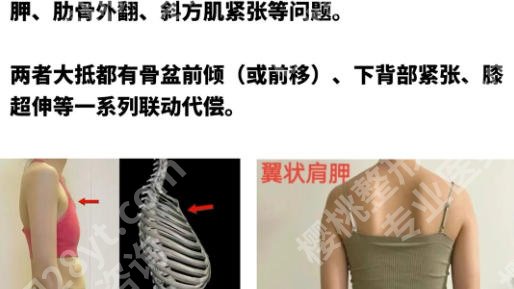 北京八大处缩胸优选删除的医生是谁啊?杨庆华、杨明勇等医生技术与价格全对比!