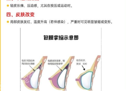 安徽省立医院丰胸专家推荐有哪些？公布人气医生资料名单分享、含医生详解！