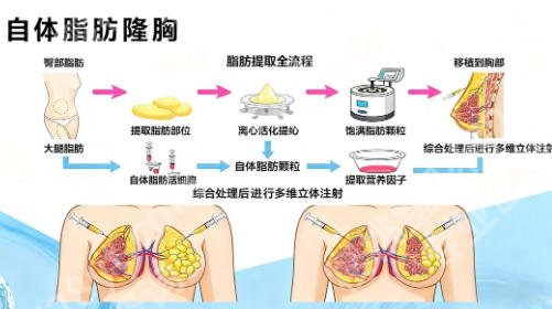 北京八大处隆胸多少钱？2026年北京八大处整形外科医院价格表全新一览表