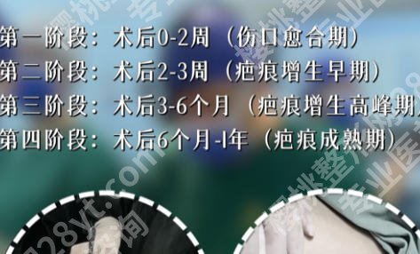 成都新华医院隆胸多少钱？2026年新公立私立价格表以及避坑指南！