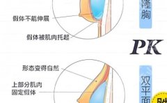 北京艺星隆胸多少钱？深扒真实价格、医生与案例多维度技术打造动感美胸！