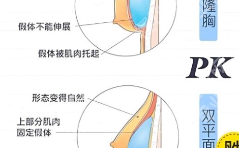 北京艺星隆胸多少钱？深扒真实价格、医生与案例多维度技术打造动感美胸！