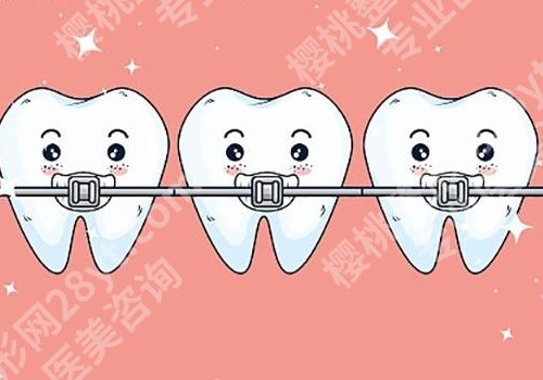 青岛牙齿矫正好的牙科有哪些？青大附院、市立医院、市口腔医院等一文讲透