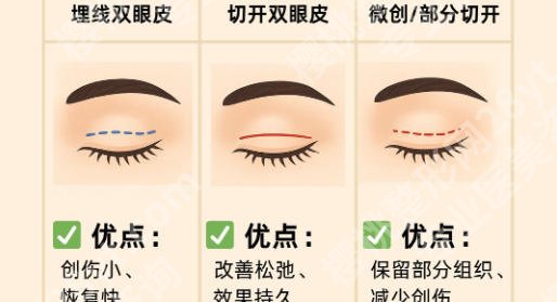 北京联合丽格做双眼皮怎么样？拒绝网红大宽主打自然款双眼皮！