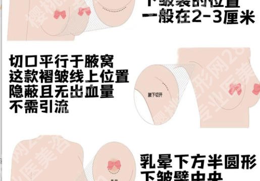 北京右安门医院隆胸专家有哪些?右安门医院医美科医生情况与术前塑美指南!