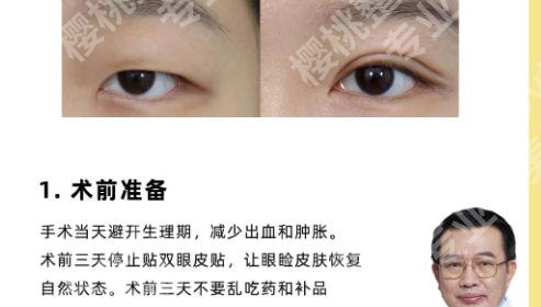 北京画美做双眼皮怎么样?医院资质/实力点评来了!含真实案例
