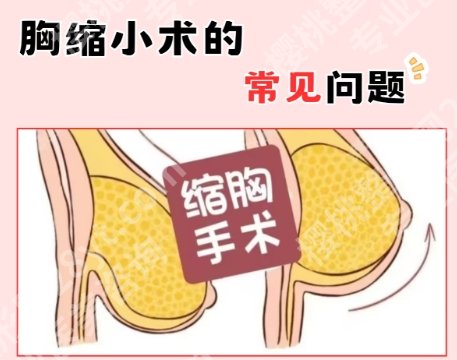 宁波第六医院缩胸多少钱？2026价格表展示！25000元到5万元不等