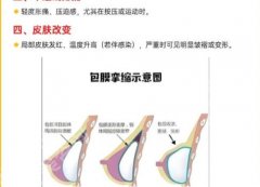 上海瑞金医院丰胸手术价格怎么样？价格低至2k起含章一新等人气医生推荐！
