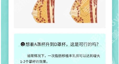 北京圣嘉新自体脂肪丰胸怎么样？自体脂肪隆胸三年，真实感受记录！