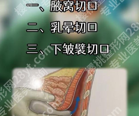 上海中山医院丰胸手术费用是多少？费用2w起包含医院优势等详细介绍！