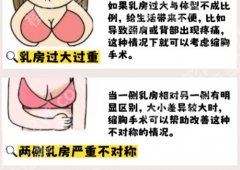 哈尔滨第五医院缩胸多少钱？内附项目介绍及客户真实口碑反馈！