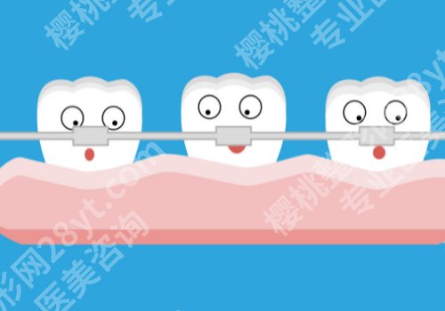 广州牙齿矫正好的医院!中山附属口腔医院、南方医大口腔医院等上榜