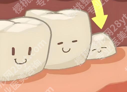 阜阳种植牙哪家医院好？5家靠谱医院实测，多个医院都有整理