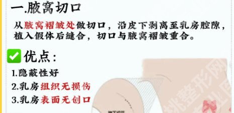 北京右安门医院隆胸怎么样？专家及医生介绍、真实案例分享在线了解！