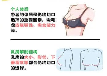 伯思立做丰胸好不好？技术咋样？网友真实口碑附上！