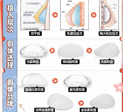 北京五洲医疗美容隆胸价格贵不贵？收费详情介绍！含用户点评