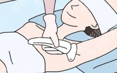 激光脱腋毛对身体有什么危害？多个危害与注意事项这里看
