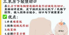 成都米兰柏羽隆胸价格怎么样？价格低至2w起含口碑评价好、人气高的医生推荐！