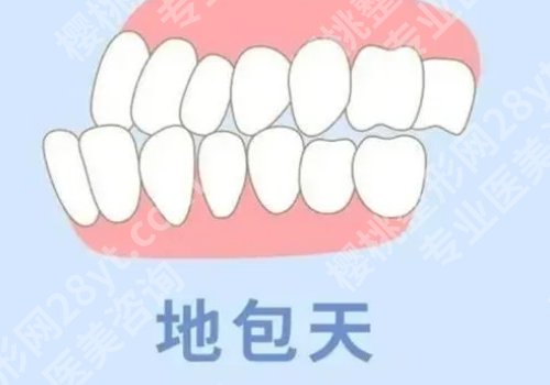 深圳牙齿矫正需要多少钱？1.2万起！热门排行榜单公开