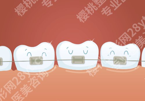 杭州牙齿矫正医院排名！2026人气TOP榜前十提前曝光