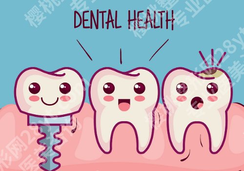 潍坊南关牙科种牙价格多少？低至9k起，亮点+案例曝光！
