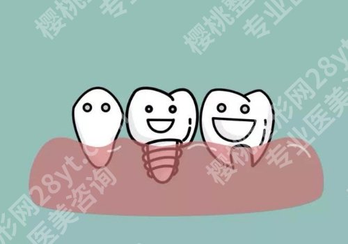孝感种植牙哪家好?中心医院、应城人民医院等口碑高!