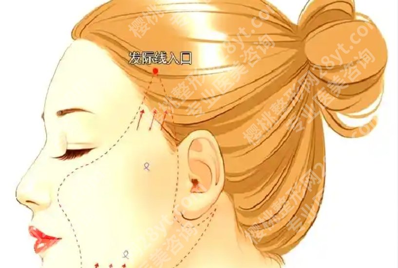 长春拉皮手术哪里做的好呢？高关注医院整理好了，选院更省心