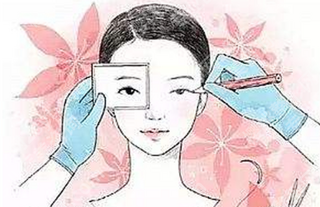 伊春哪家做双眼皮好?本地人气机构整理，想做先看看