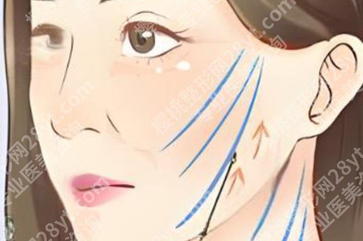 沈阳做拉皮手术哪家医院好?热门医院盘点好了,想做先收藏
