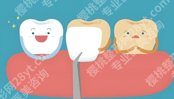 临汾种一颗牙多少钱？价格大揭秘，差别主要是这三点