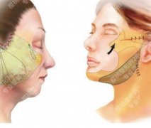 吉林省做拉皮的医院有哪些？省内可选名单汇总，做功课先收好