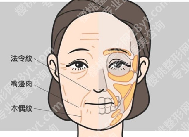 哈尔滨做拉皮手术需要多少钱？费用区间和预算方向先帮你理顺