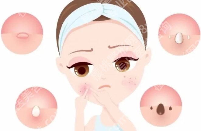 牡丹江哪家皮肤科医院好？看皮肤项目时常被问到的医院整理好了