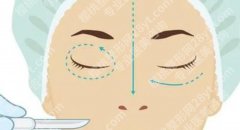 辽源割双眼皮哪家好？风格、价格和医院类型都值得一起比