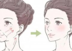 伊春整形美容哪家好？机构特色和项目方向这次分开来说