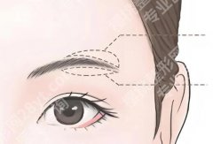 纹眉和绣眉的区别在哪里？区别太大了！别再傻傻分不清